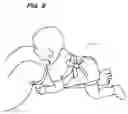 Fig. 09 - Apparatus and method for exercising with a child attached to the legs