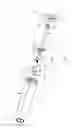 Fig. 09 - Handheld misting device with pressure-relieving handle