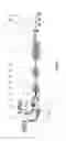Fig. 02 - Method and device for producing a continuous strip-shaped composite material