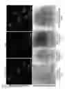 Fig. 04 - PLATELET TARGETED TREATMENT