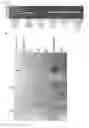 Fig. 07 - PLATELET TARGETED TREATMENT