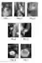 Fig. 02 - Methods and compositions for in-situ polymerization reaction to improve shale inhibition