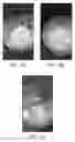 Fig. 07 - Methods and compositions for in-situ polymerization reaction to improve shale inhibition