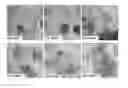 Fig. 01 - Method for inducing differentiation of pluripotent stem cells into neural precursor cells