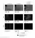 Fig. 02 - Method for inducing differentiation of pluripotent stem cells into neural precursor cells