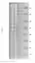 Fig. 08 - High Throughput Reaction Assembly