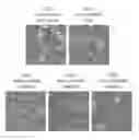 Fig. 01 - TREATING CANCER