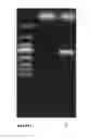 Fig. 01 - Method for direct transformation of exogenous DNA into resting spores of 
