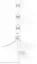 Fig. 06 - Multipurpose combined flexible floating breakwater