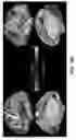Fig. 28 - Methods and tools for detecting, diagnosing, predicting, prognosticating, or treating a neurobehavioral phenotype in a subject