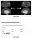 Fig. 30 - Methods and tools for detecting, diagnosing, predicting, prognosticating, or treating a neurobehavioral phenotype in a subject