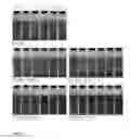 Fig. 15 - Stabilization of carrageenan free chocolate milk