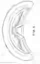 Fig. 07 - Head protection hood with integrated frame