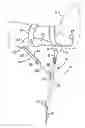 Fig. 01 - Portable deployable stanchion to assist an individual at rest