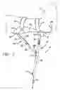 Fig. 02 - Portable deployable stanchion to assist an individual at rest