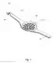 Fig. 02 - Device for the prevention of cooking boilover