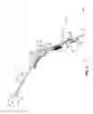 Fig. 02 - Instrument port with fluid flush system