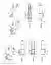 Fig. 02 - ENDOSCOPY AND HYDROTHERAPY SPECULUM