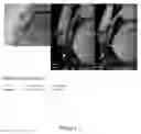 Fig. 09 - METHOD FOR DETERMINING DIASTASIS TIMING USING AN MRI SEPTAL SCOUT