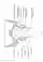 Fig. 09 - Screening devices and methods for obstructive sleep apnea therapy