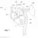 Fig. 02 - Automated CCHD screening and detection