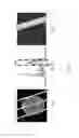 Fig. 08 - METHOD OF RADIATION DOSE REDUCTION VIA FRACTIONAL COMPUTERIZED TOMOGRAPHIC SCANNING AND SYSTEM THEREOF