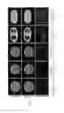 Fig. 09 - METHOD OF RADIATION DOSE REDUCTION VIA FRACTIONAL COMPUTERIZED TOMOGRAPHIC SCANNING AND SYSTEM THEREOF