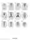Fig. 07 - System and methods for assessing presence of large vessel occlusion to aid in transfer decision-making for endovascular treatment in patients with acute ischemic stroke