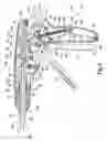 Fig. 07 - Staple cartridges for forming staples having differing formed staple heights