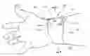 Fig. 01 - Ultrasound compatible inflatable vascular compression and related systems and methods