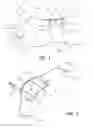 Fig. 02 - Ultrasound compatible inflatable vascular compression and related systems and methods