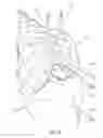 Fig. 44 - Knee instruments and methods