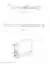 Fig. 13 - Surgical drill guide systems and methods of use thereof