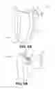 Fig. 06 - Medical devices and related methods