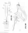 Fig. 07 - Medical devices and related methods