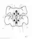 Fig. 09 - Alignment guide for cervical spine plate