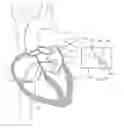 Fig. 01 - Electrosurgical device having a distal aperture