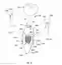 Fig. 03 - Fabrication and installation of a dental implant