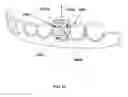Fig. 17 - Fabrication and installation of a dental implant