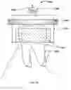 Fig. 20 - Fabrication and installation of a dental implant