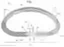 Fig. 02 - Actively-engageable movement-restriction mechanism for use with an annuloplasty structure