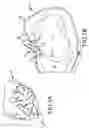 Fig. 02 - Trans-catheter ventricular reconstruction structures, methods, and systems for treatment of congestive heart failure and other conditions