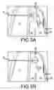 Fig. 09 - Trans-catheter ventricular reconstruction structures, methods, and systems for treatment of congestive heart failure and other conditions