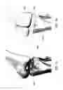 Fig. 02 - Magnetic prosthetic