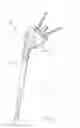 Fig. 02 - Shoulder arthroplasty system