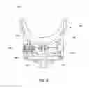 Fig. 09 - Prosthetic limb sockets and methods of making and using