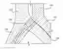 Fig. 01 - Implantable stent