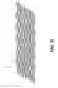 Fig. 10 - Implantable stent