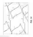 Fig. 12 - Implantable stent