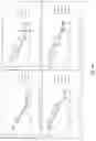 Fig. 20 - Prostate-specific membrane antigen cars and methods of use thereof